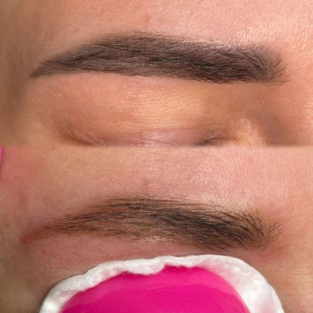 antakiu permanento salinimas